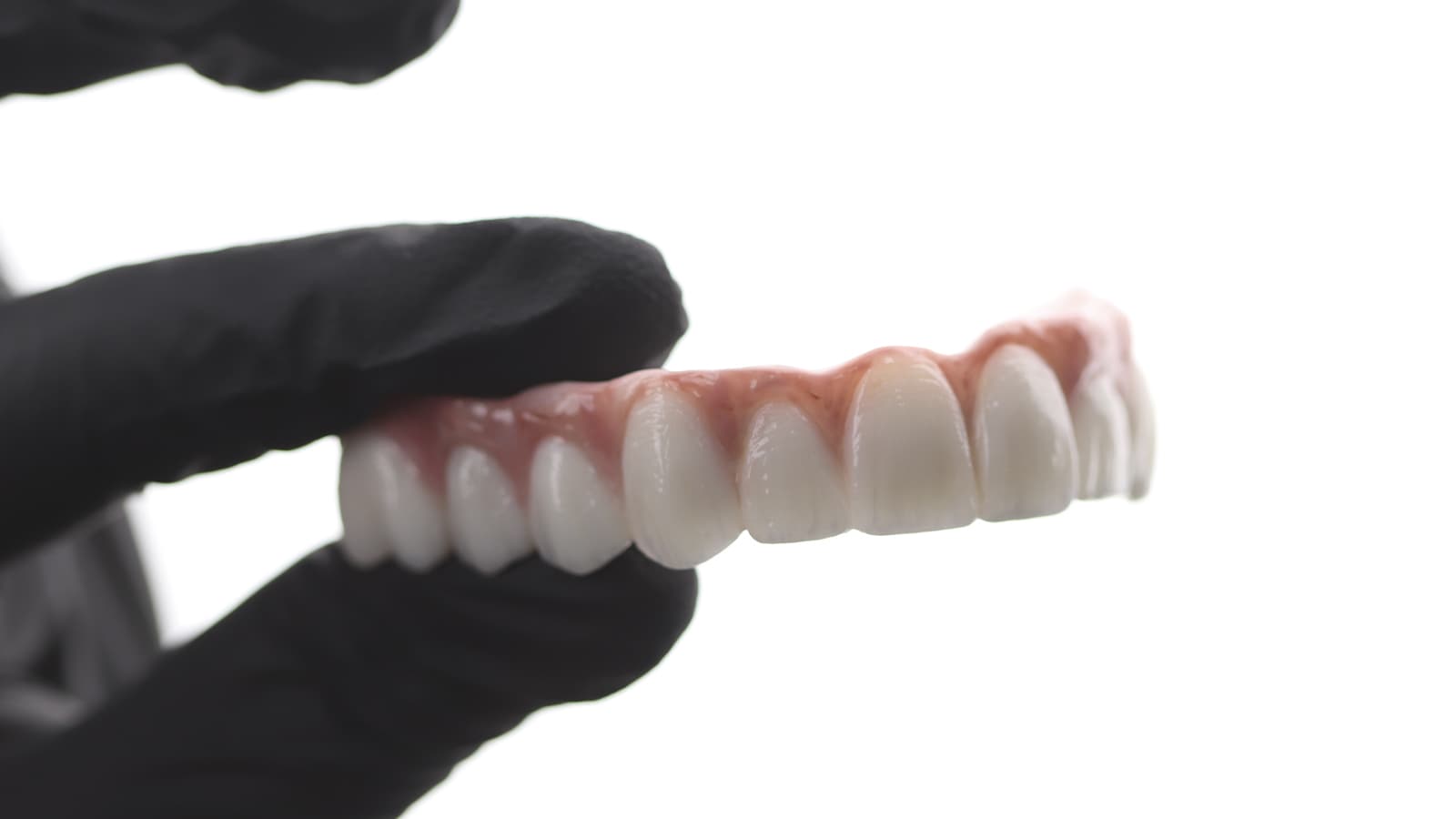 Dental Treatment Results Gallery