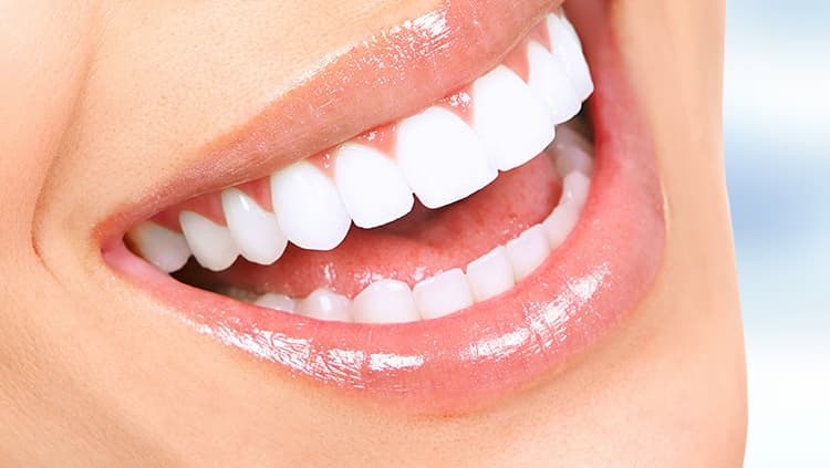 Porcelain Veneers at America Dental