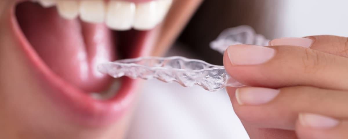 Dental Night Guards at America Dental