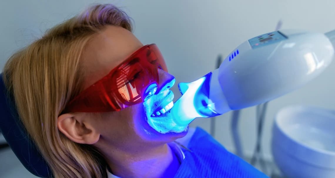 Professional Tooth Whitening at America Dental