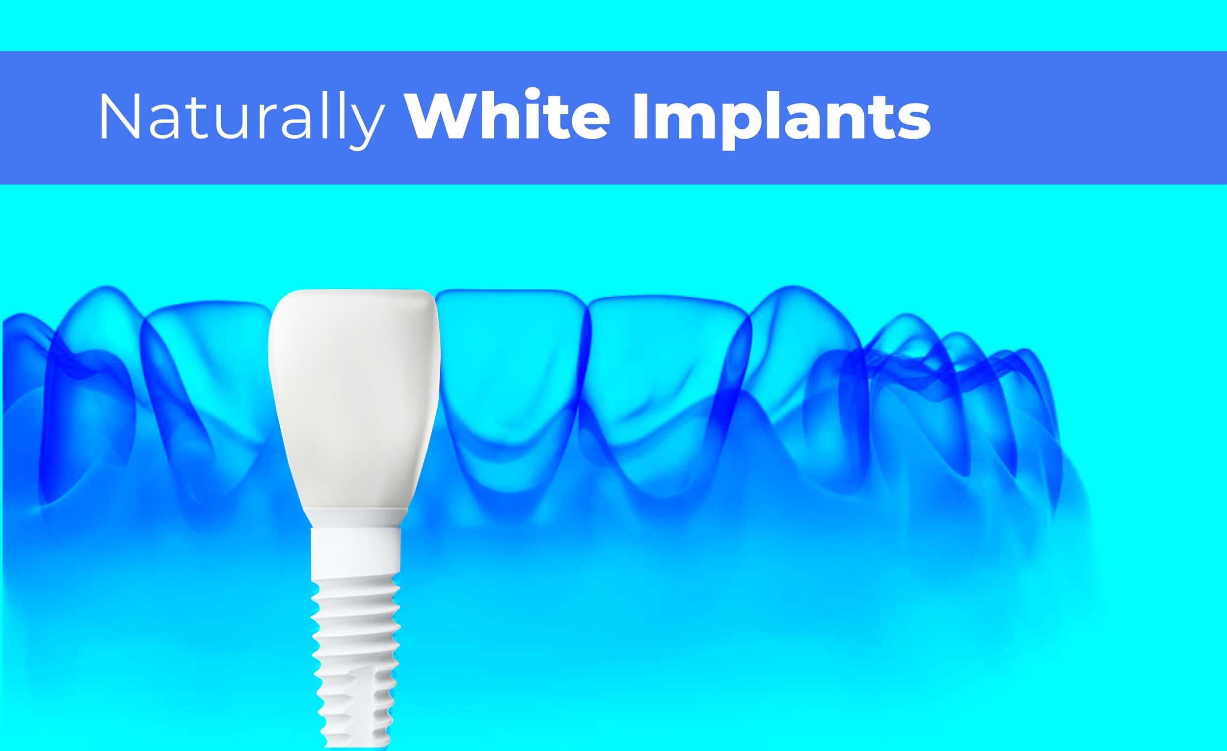 Zirconium Dental Implants in Costa Rica at America Dental Clinic